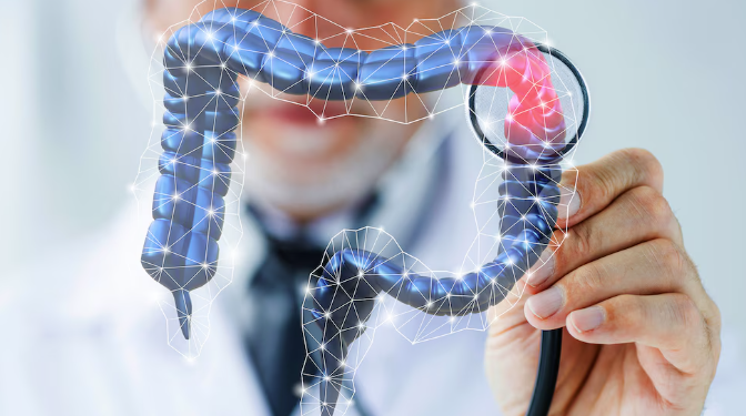 Antecedentes familiares y genética duplican el riesgo de cáncer de colon antecedentes-familiares-y-genetica-duplican-el-riesgo-de-cancer-de-colon