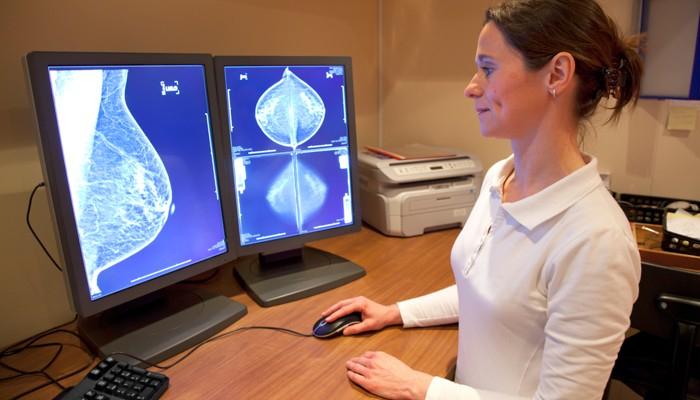 Atención multidisciplinaria: un modelo centralizado que acelera el diagnóstico temprano del cáncer